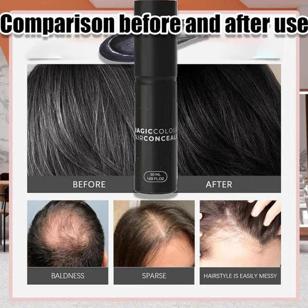 Kaviq Scalp Concealer – Full Hair, Full Confidence ( Buy 1 Get 1 Free )